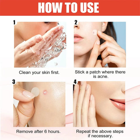 Pimple cover up Stickers