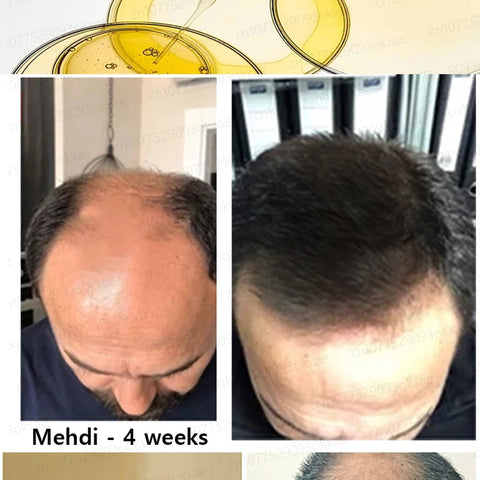 Bottle Hair Growth Essential Oil