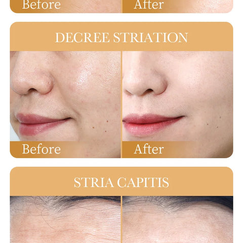Anti-wrinkle collagen face mask