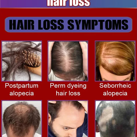 Bottle Hair Growth Essential Oil