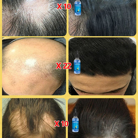 Bottle Hair Growth Essential Oil