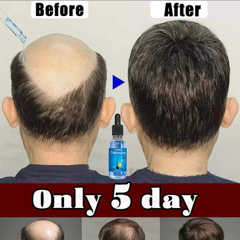 Bottle Hair Growth Essential Oil